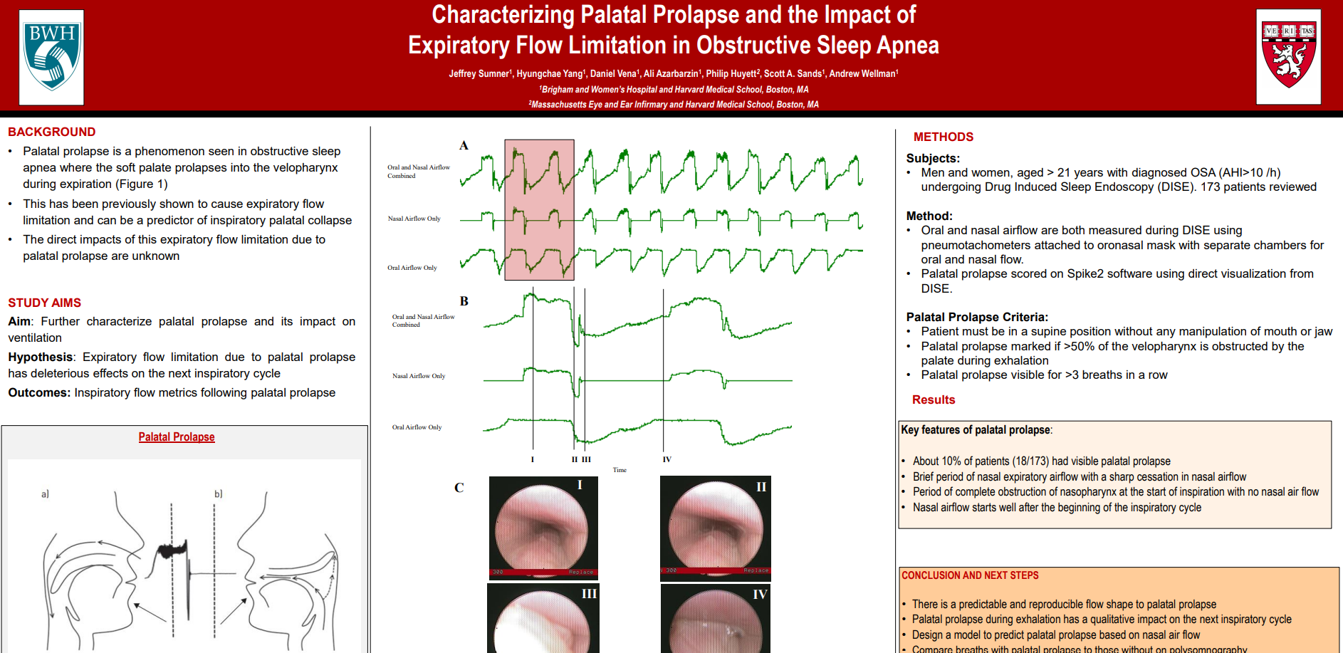 Characterizing Palatal Prolapse and the Impact of Expiratory Flow Limitation in Obstructive Sleep Apnea 2022
